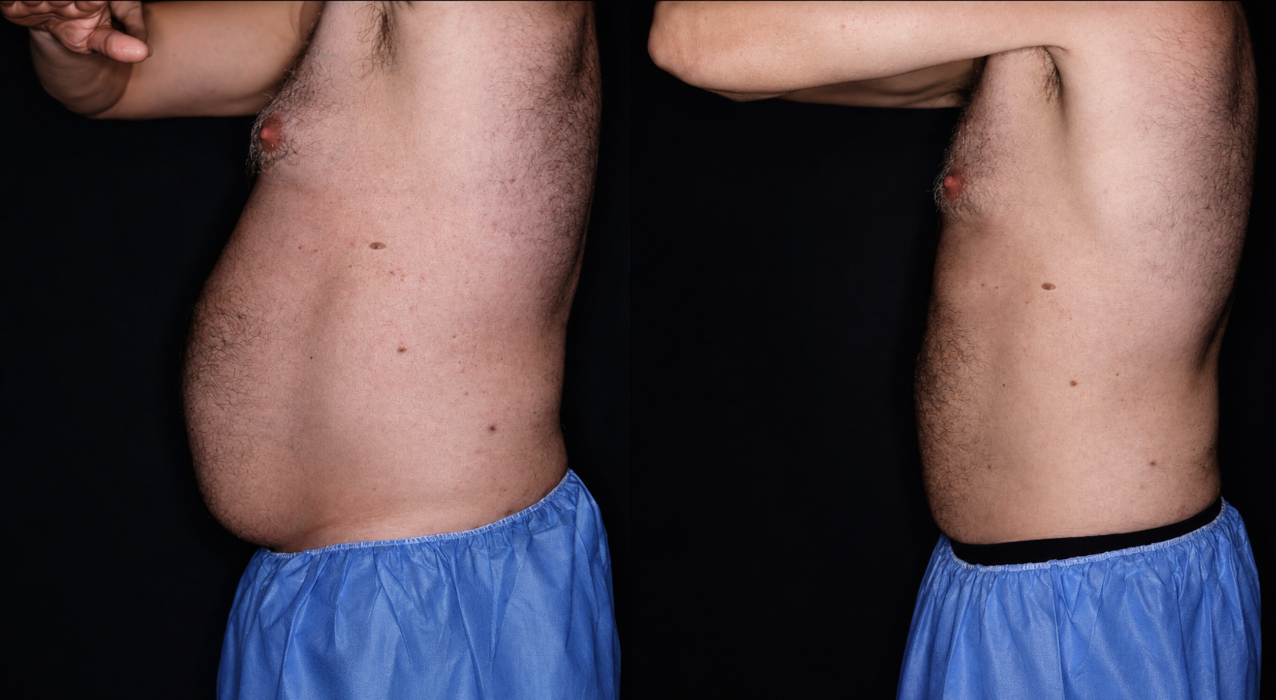 Before and after