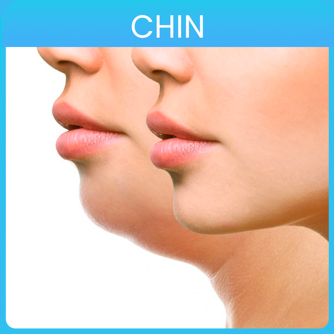 chin-Sep-28-2022-06-59-05-05-PM