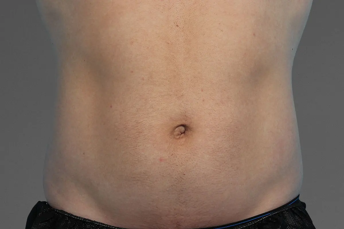 Muscle toning before